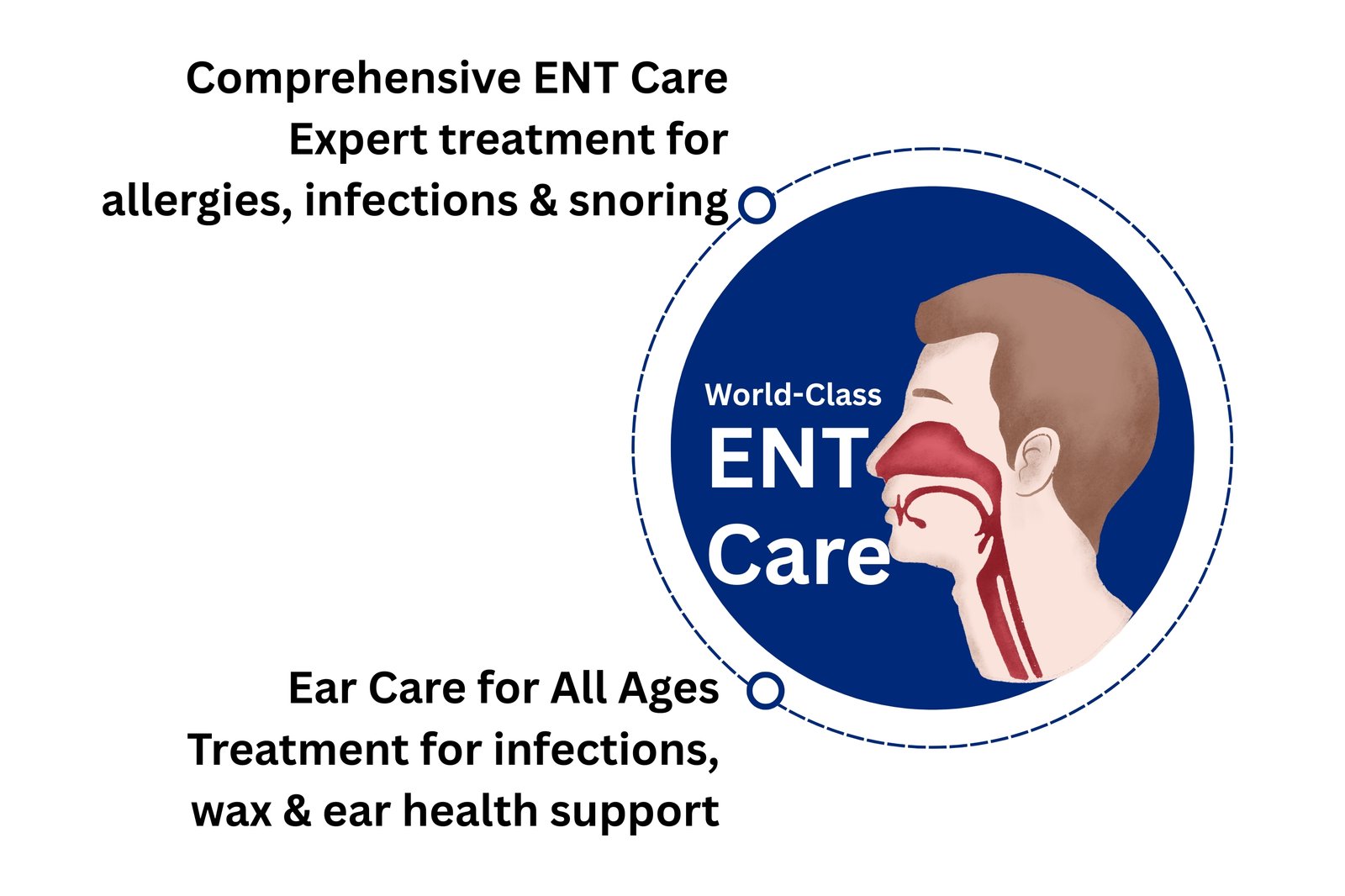 ENT – ORL